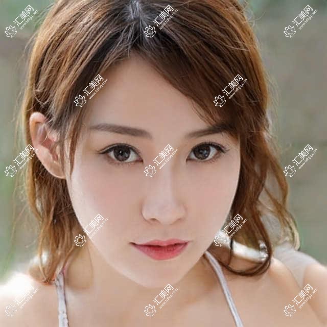 合肥V-LINE瓜子脸手术收费表预览,想变好看的小伙伴可以参考