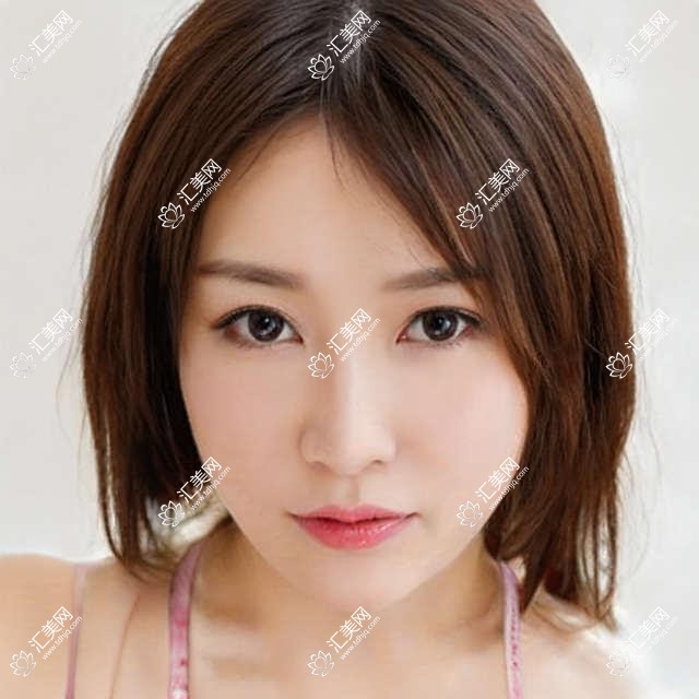 到南通找这些眼部整形医生,重塑魅眼更年轻