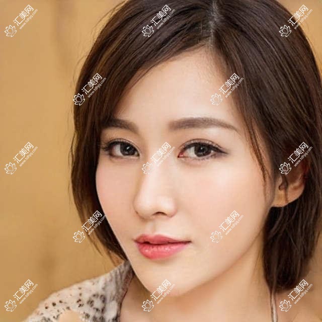 上海希玛眼科近视手术费用揭秘？全飞秒近视矫正约1W+ 晶体植入2W+ 高度近视ICL方案详询