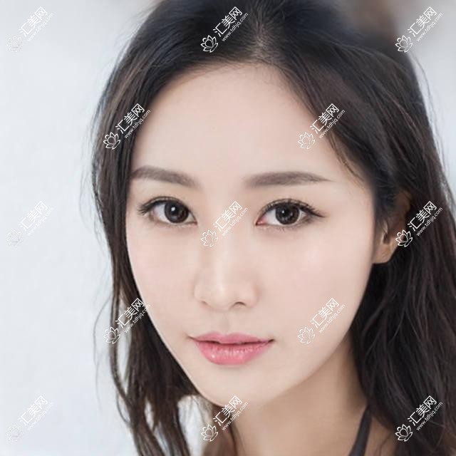 上海华美整形价格揭秘？隆鼻1W-3W/吸脂8K-2W/眼部综合2W+