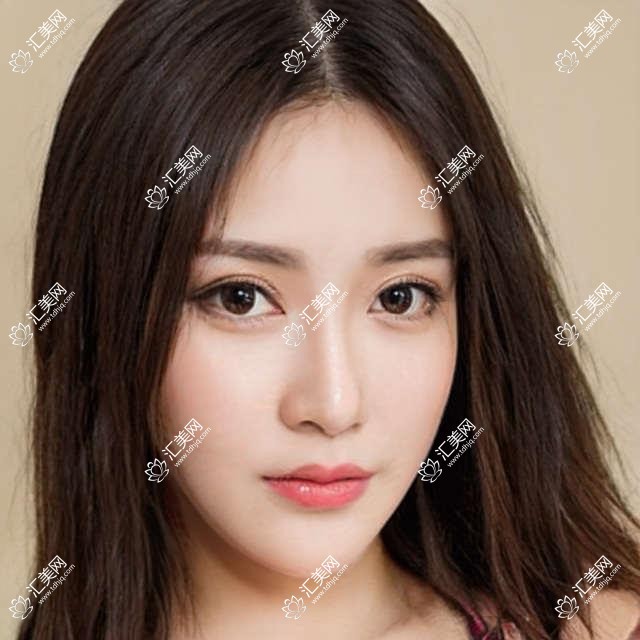 烟台牙齿修复矫正医生推荐:蒋雪飞孙旭涛田昆鹏擅长种植矫正