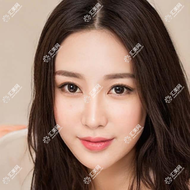 广州星面医美全攻略:解锁热门项目价格清单