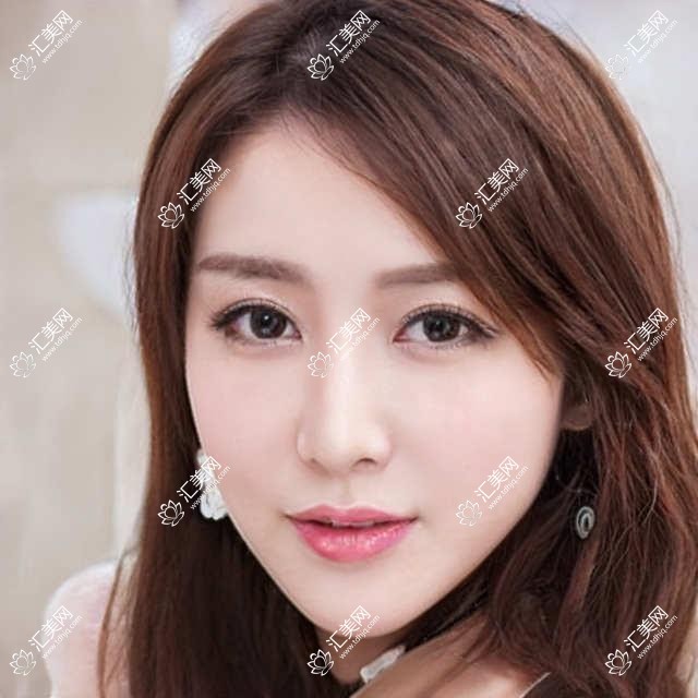 上海市齐梅口腔植牙费用揭秘？普通植牙1W+ 隐形矫正2W+ 全瓷牙冠3K+