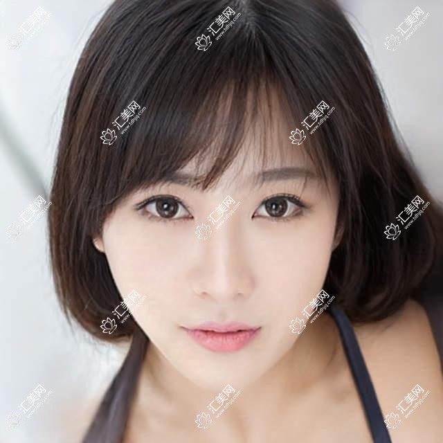 台州自体脂肪填充丰面颊收费2025年新详尽公开-台州市肿瘤医院/台州悠美丽思医疗美容自体脂肪填充丰面颊价格表(收费)