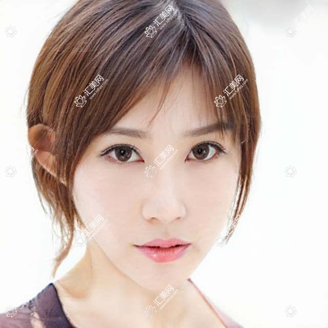 柳州胶原蛋白填充祛黑眼圈哪家好?推荐柳州胶原蛋白填充祛黑眼圈口碑好还正规的医院