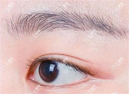 潍坊明润眼科全项目价格表:半飞秒/全飞秒近视矫正+散光治疗+TICL/ICL晶体植入+准分子激光详列