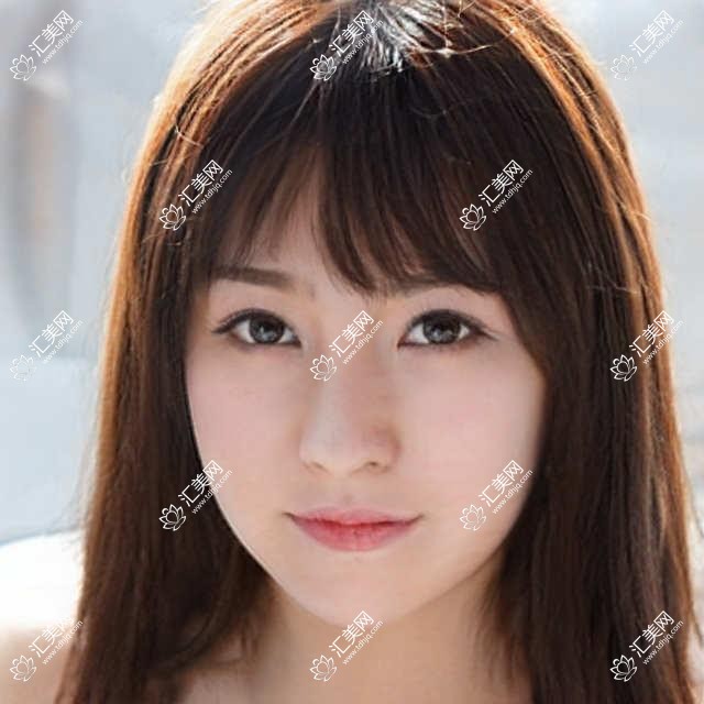 金华眼科医生推荐榜:白内障超声乳化&近视矫正名医汇聚(含特色项目+医院指南)