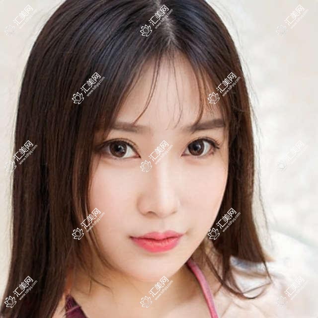 福州义眼排行榜及价格分享!好还不贵的医院是那家呢?