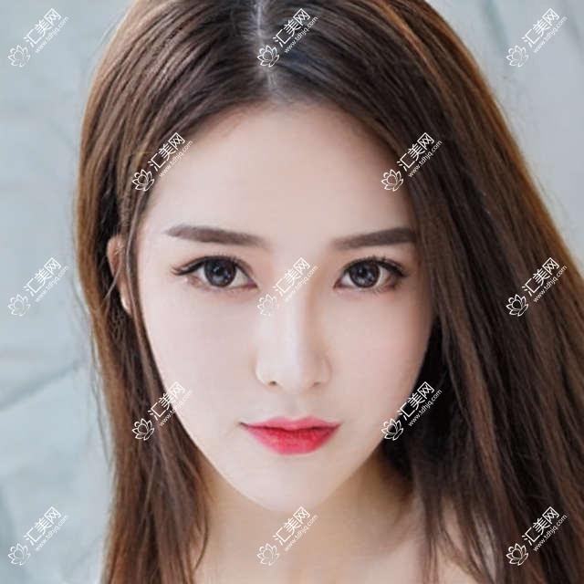 宿迁口腔医生推荐:徐伟李发可精通即刻种植牙,技术精细,口碑优良!