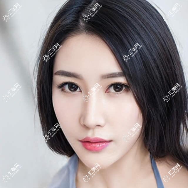 武汉近视矫正医生赵志国刘莉周跃明测评,激光全飞秒ICL晶体植入技术精细