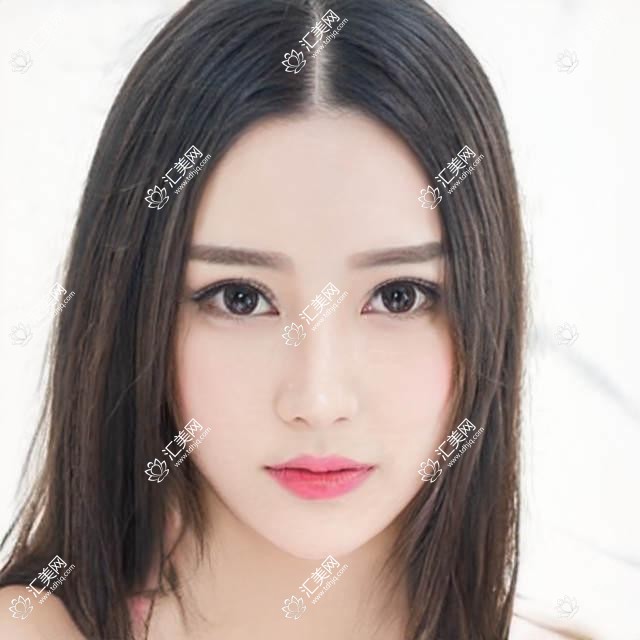广州斜视价目表(收费)-广州斜视便宜贵不贵