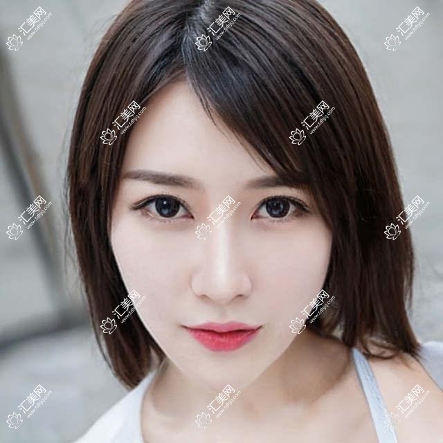 2025青岛德国阿玛仕750rs全激光价格表:德国蔡司mel90全激光/德国阿玛仕1050rs半飞秒激光/德国阿玛仕750rs全激光等德国阿玛仕750rs全激光价格总览
