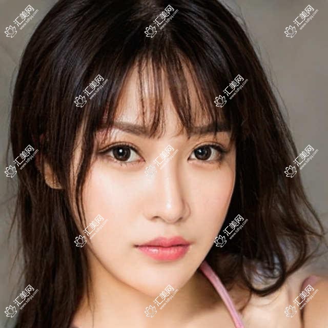 2025西安微创种植多少钱?国产种植牙5.5千+/半口牙种植5.4万+/后牙种植1.7万+