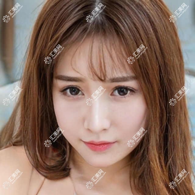 成都近视手术医生推荐!鲍捷、谢冰、余小清技术精细,口碑优良,详情速览!