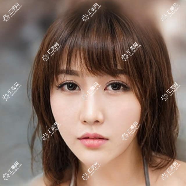 北京市华韩医美整形费用揭秘?隆鼻约2W+ 双眼皮1W+ 皮肤管理年卡8K+