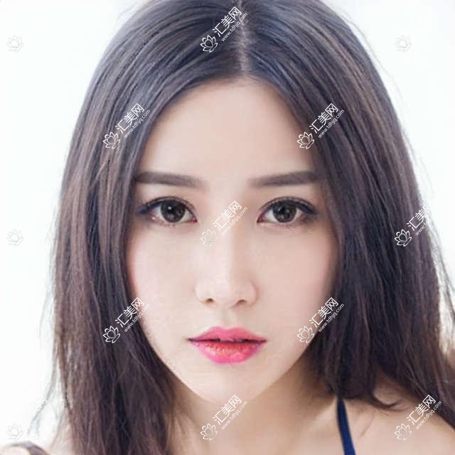 邢台擅长眼部诊疗医生测评,王庆瑛左相荣姚长海,全飞秒及白内障技术受好评