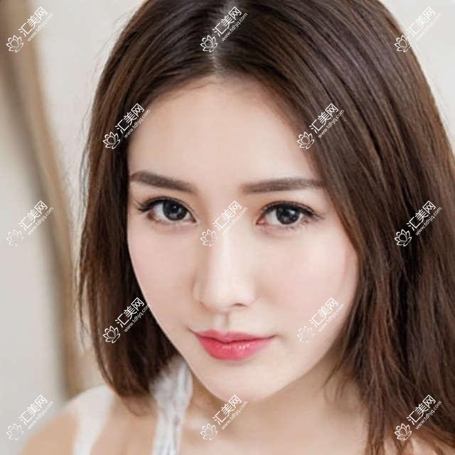 烟台有名眼科医生推荐:卓旭英、由海涛精于眼部健康手术