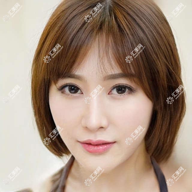 成都市大象致颜鼻专科医美多少钱？肋骨鼻2W+ 玻尿酸隆鼻8K+ 鼻综合4W+