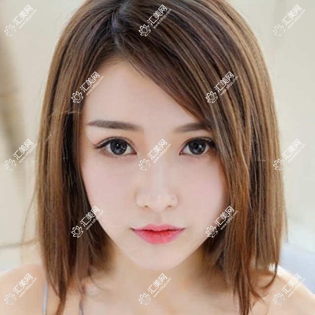 北京市熙仁眼科弱视矫正费用揭秘?激光矫正约1W+ 角膜塑形镜8K+ OK镜6K+