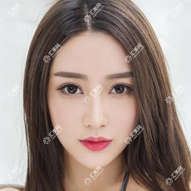 上海华美整形项目价格揭秘:隆鼻8K起,吸脂1.5W起,眼部综合2W元起