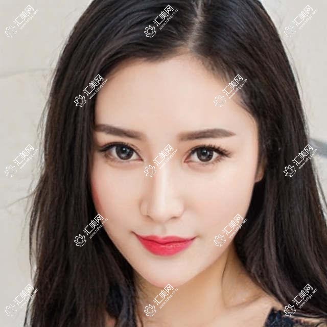 嘉兴医美精选医生排行,眼部鼻部及皮肤抗衰医生名单参考