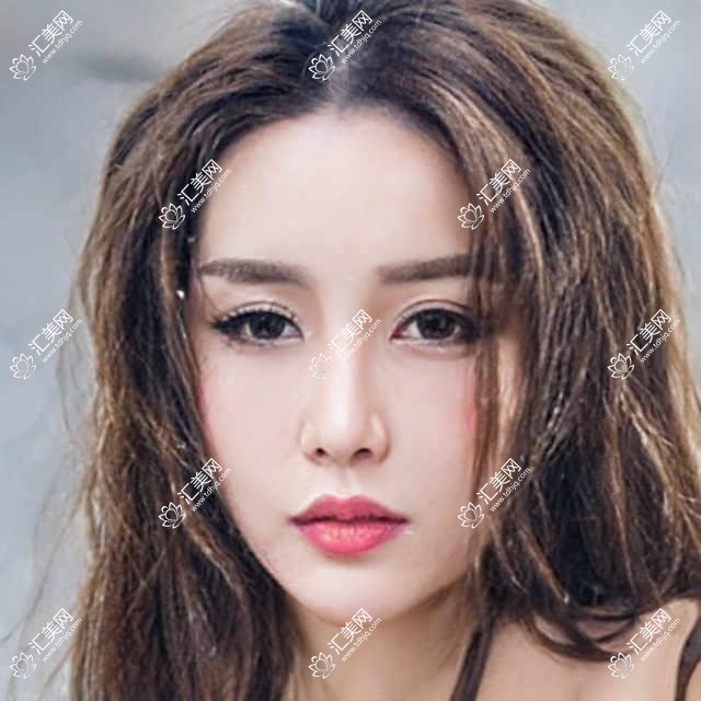 北京达美美容门诊全项目价格揭秘:埋线微整到脂肪填充,详细报价一览