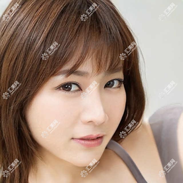 芜湖地区眼部整形医生推荐:朱唯力, 孙群, 赵启明技术精细