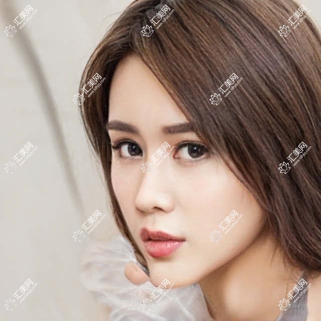 宁波睑裂延长医院荣誉榜前五:宁波益宝医疗美容、宁波江北复大医院深度多面解析,正规收费透明公开!