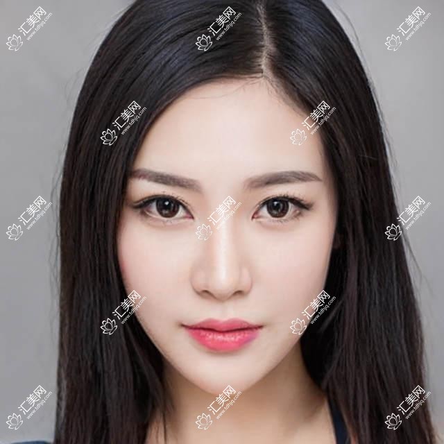 南宁德国鹰视EX200+鹰视EX500半飞秒激光排行榜及价格介绍!价格也不贵的医院是那家呢?