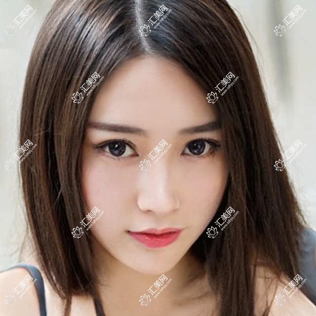 2023成都健丽医美项目价目详解:眼整形8K-3W+ 肤管理5K-2W+