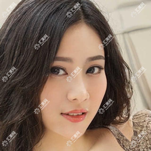 徐州点痣哪一个医院好?硬实力声誉比较:徐州美特莱斯医疗美容