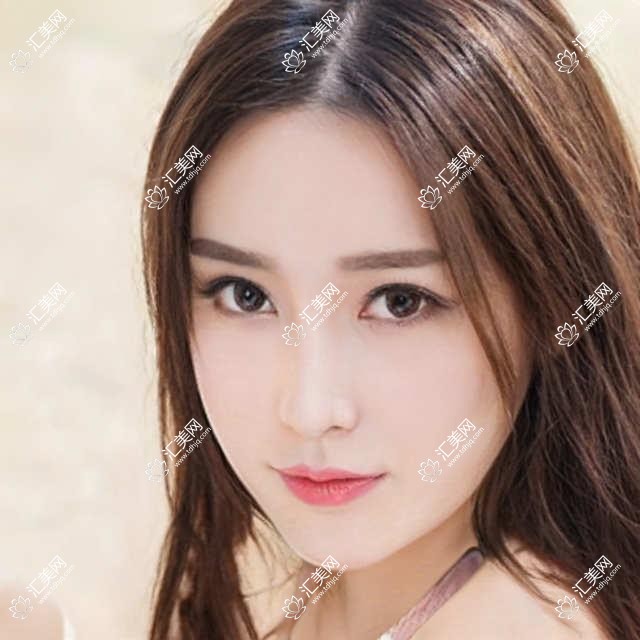 成都医美攻略:成美整形科热门项目价格揭秘,眼鼻整形到皮肤管理一网打尽