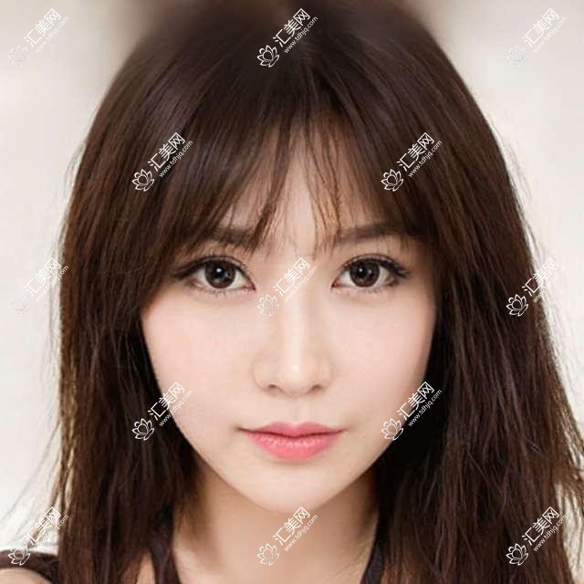 武汉市伊妍医美门诊部轮廓整形价格揭秘?下颌角1.5W+ 颧骨内推2W+ 鼻综合3W+