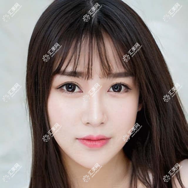 成都市四川成都美妍整形私密科费用揭秘?紧致手术1W+ 私密漂红2W+ 激光脱毛3K+