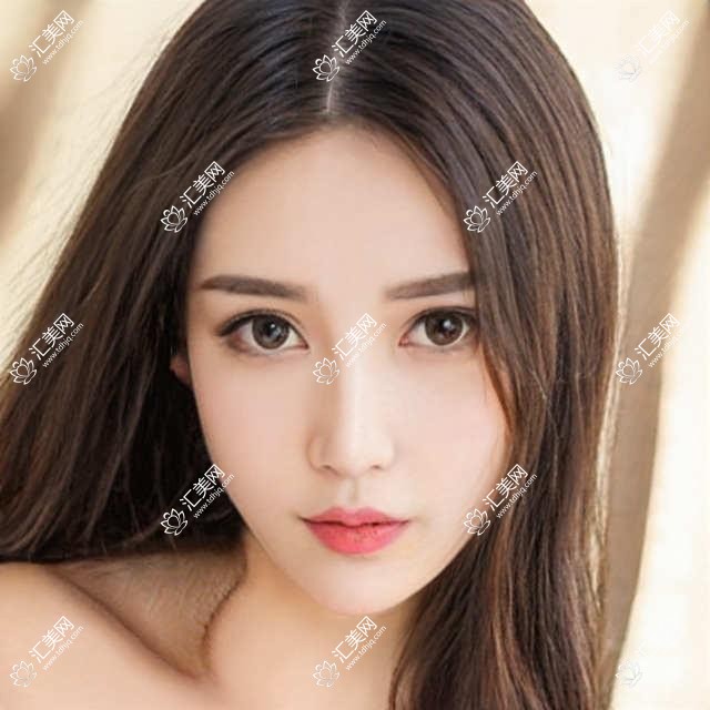 柳州有名整形医生杨克刘豪陈毓南,精通眼部鼻部及抗衰塑形