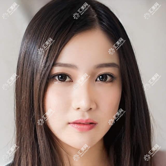 临沂美国爱尔康FNT00三焦点人工晶体价格多少钱?2025价目单:德国蔡司839MP三焦点人工晶体21000元起、美国强生眼力健新无极(Symfony)人工晶体21000元起