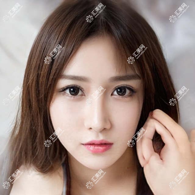 长春光子祛斑大概是多少钱?当地建议医院介绍