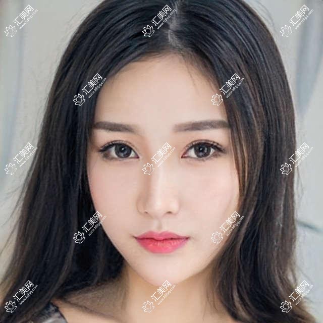 昆明射频溶脂瘦腰多少钱?价格在3898-30499,腰部吸脂5千-3万