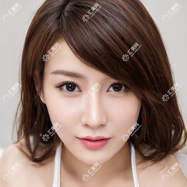 揭秘成都普瑞眼科全项目价格表,亲测详细清单仅需3万起,透明实惠选得放心!