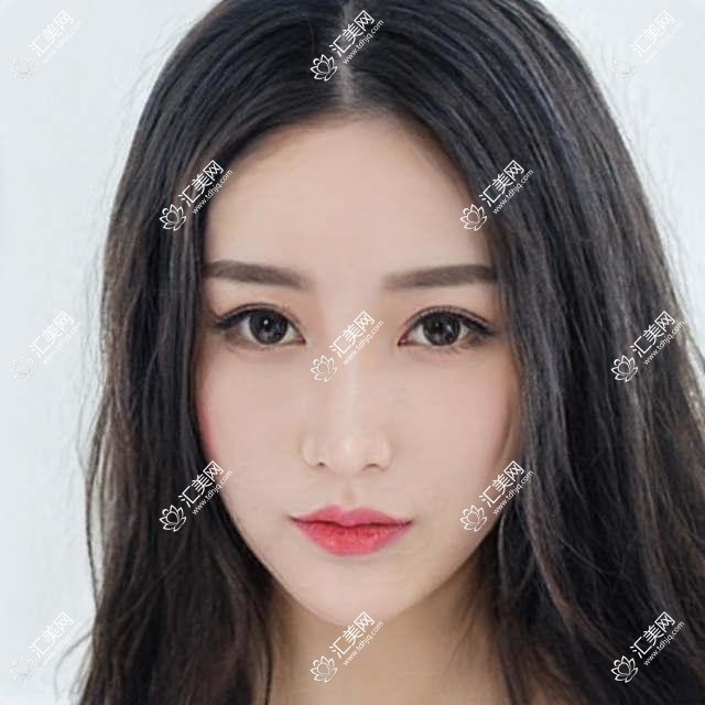 昆明精选几位医生做音波拉皮与美体塑形,焕新颜容