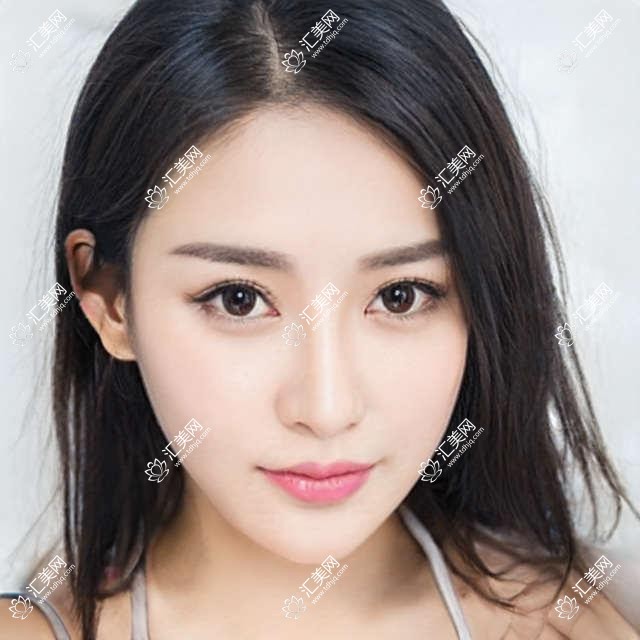 寻商丘这些眼部整形医生,焕新双眸点亮美丽