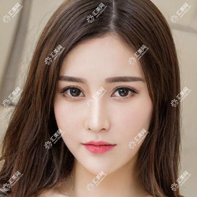 阜阳眼科医生推荐:蔡磊琳、王丹梅,精通激光近视矫正、晶体植入术