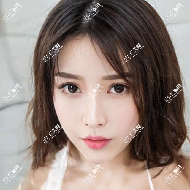台州私密整形与抗衰老医生推荐:吴伟、刘兴达、张艳,精通私密整形、面部抗衰
