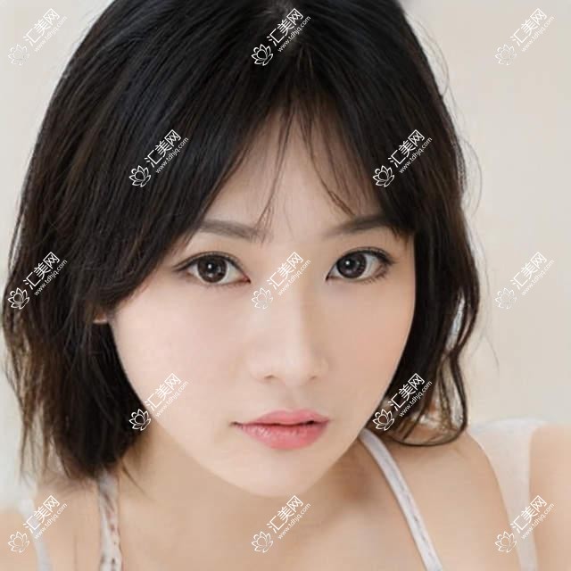 中山眼部整形哪位医生受欢迎?推荐雷晓军, 吴善宏, 赵志国三位医生