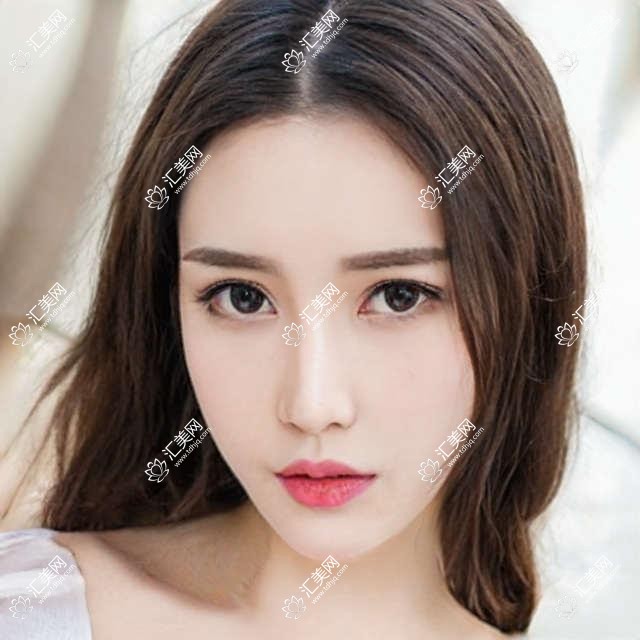 天津市华中医美多少钱?双眼皮8K+隆鼻1.5W+皮肤管理5K+