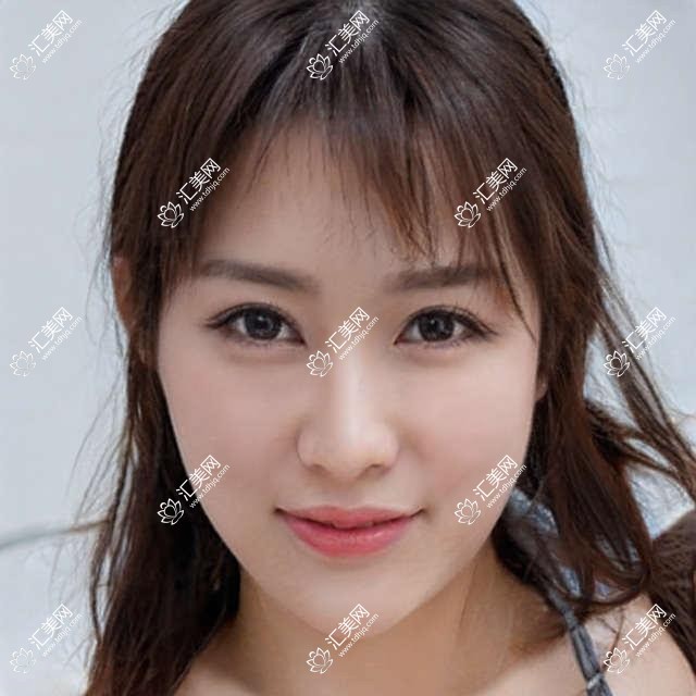 成都中山肤值医美揭秘:热门医美项目如光子嫩肤 价格全览