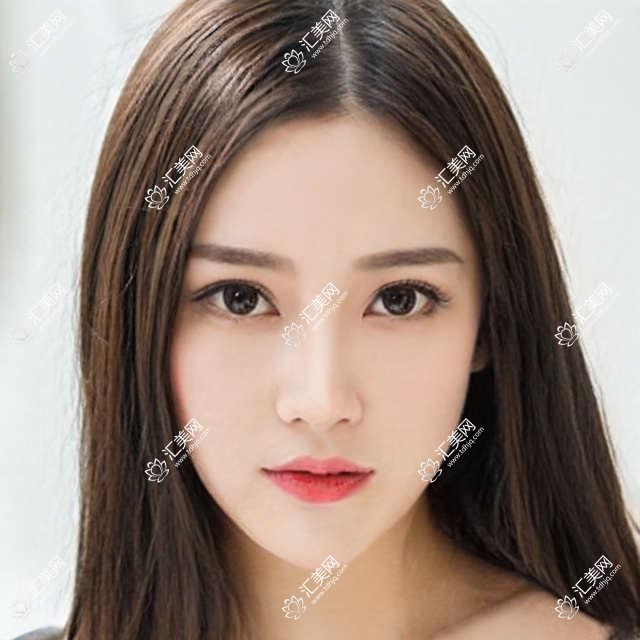 广州曙光医美医院价格揭秘？双眼皮8K+ 隆鼻1.5W+ 吸脂塑形2W+