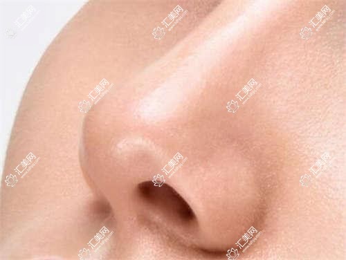 武汉市媄妲医美埋线提升价格揭秘?面部提升1.5W+ 隆鼻2W+ 套餐3K+