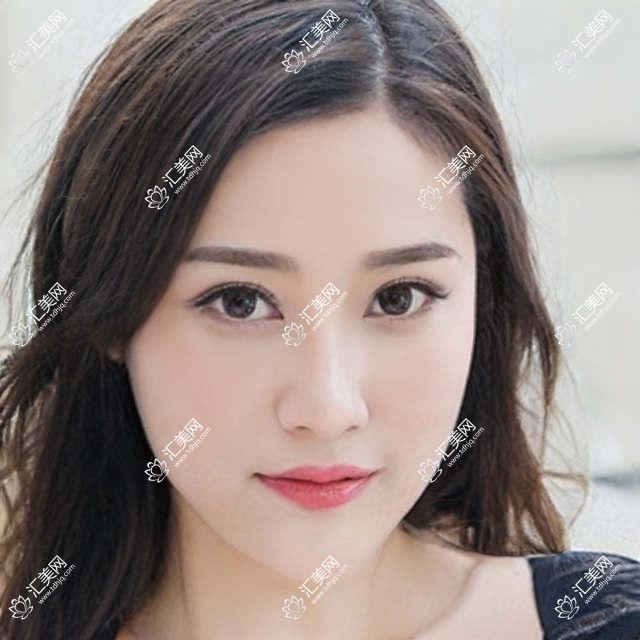 江门鼻综合与隆胸医生推荐:毛孝忠、祝宁斯、周俊,精通鼻整形、自体脂肪丰胸