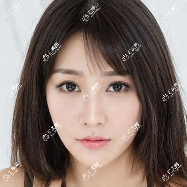杭州医美医生推荐:眼部整形、面部年轻化及抗衰老去皱有名医生榜单!